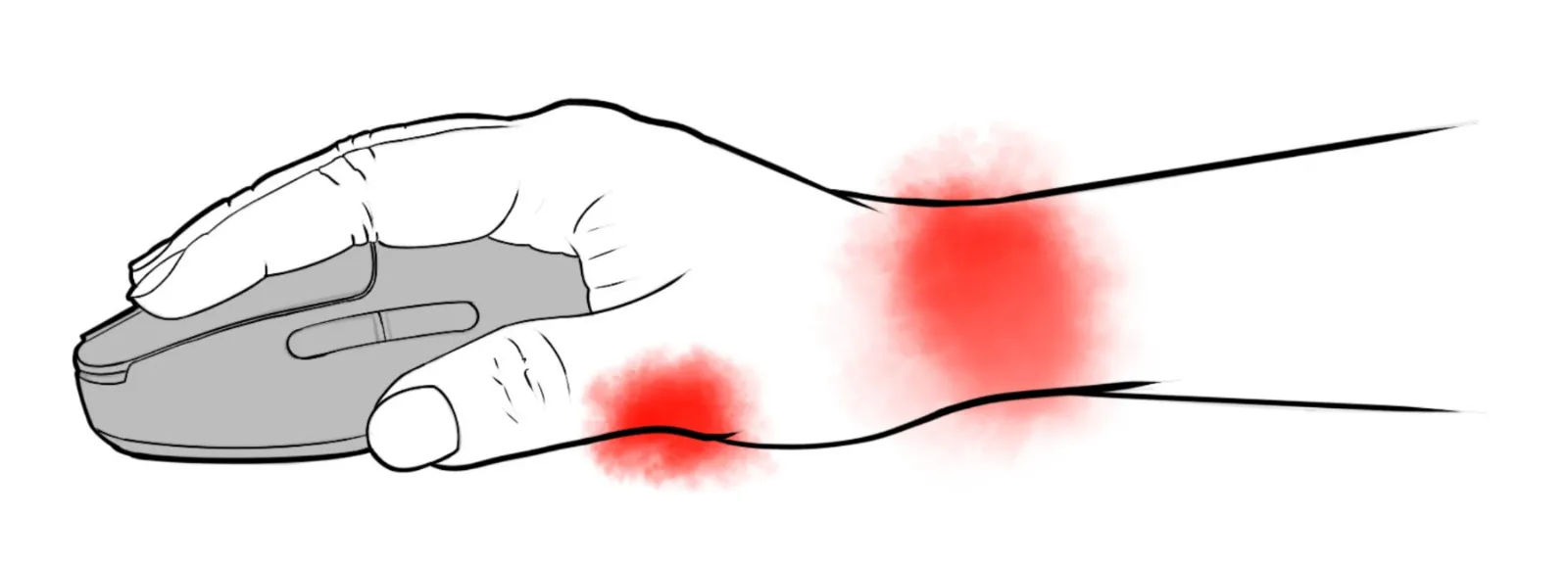 Stress on hand